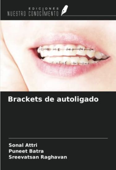 Brackets de autoligado