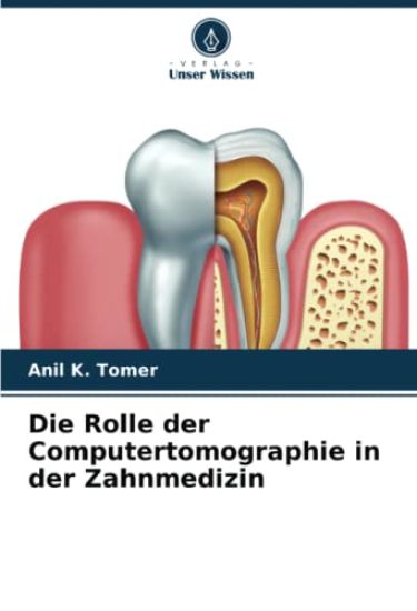 Die Rolle der Computertomographie in der Zahnmedizin