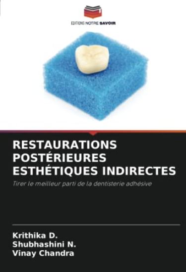 Restaurations Postérieures Esthétiques Indirectes