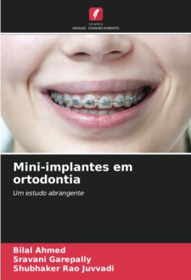 Mini-implantes em ortodontia