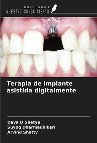 Terapia de implante asistida digitalmente