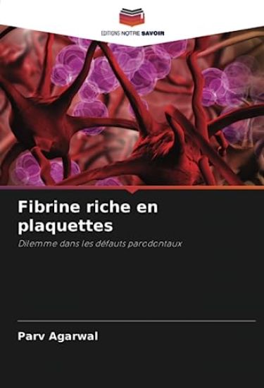 Fibrine riche en plaquettes