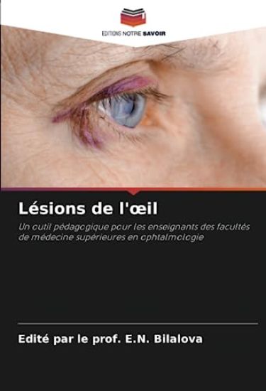 Lésions de l'oeil