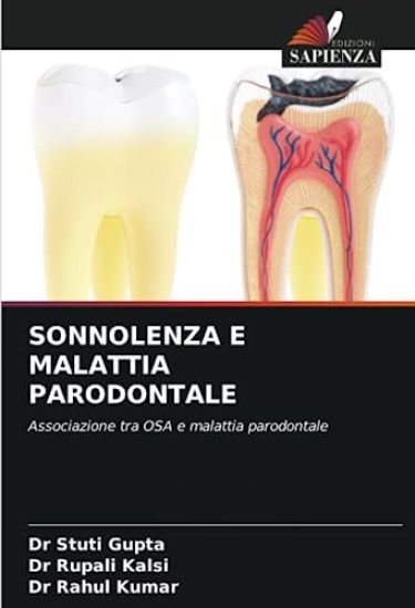 Sonnolenza E Malattia Parodontale