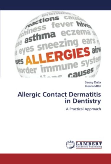 Allergic Contact Dermatitis in Dentistry