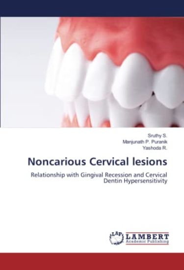 Noncarious Cervical lesions