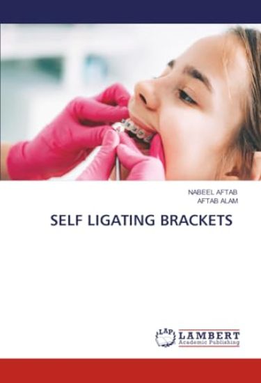 Self Ligating Brackets