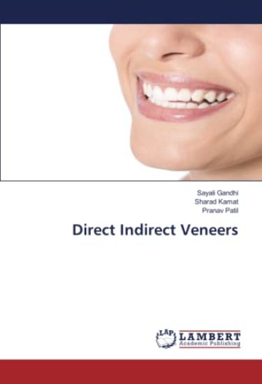 Direct Indirect Veneers