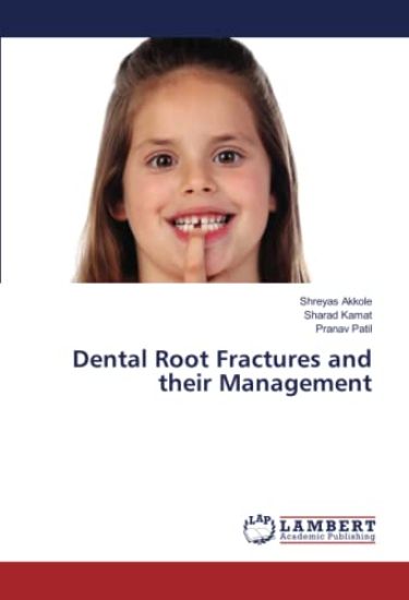 Dental Root Fractures and their Management