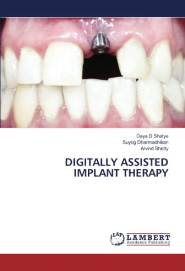 Digitally Assisted Implant Therapy