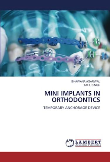 MINI IMPLANTS IN ORTHODONTICS
