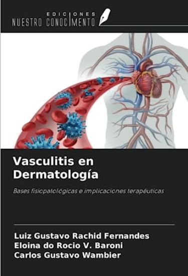 Vasculitis en Dermatología