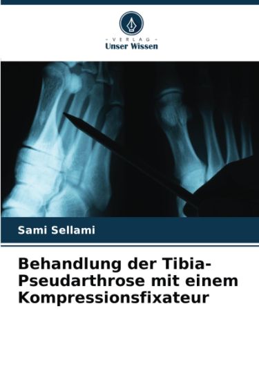 Behandlung der Tibia-Pseudarthrose mit einem Kompressionsfixateur