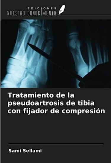 Tratamiento de la pseudoartrosis de tibia con fijador de compresión