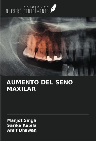 AUMENTO DEL SENO MAXILAR