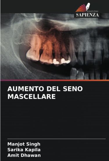 Aumento del Seno Mascellare