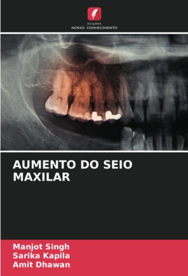 Aumento Do Seio Maxilar