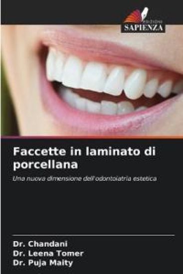 Faccette in laminato di porcellana