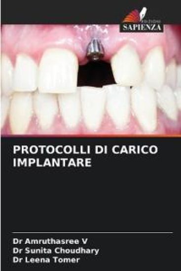 Protocolli Di Carico Implantare