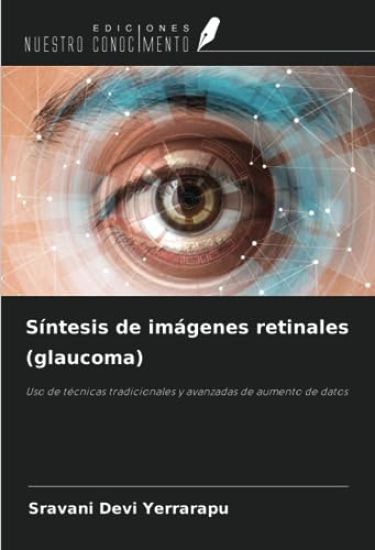 Síntesis de imágenes retinales (glaucoma)
