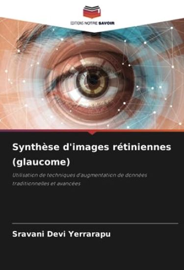 Synthèse d'images rétiniennes (glaucome)