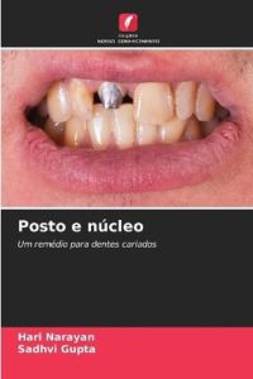 Posto e núcleo