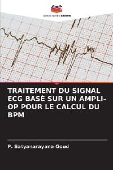Traitement Du Signal ECG Basé Sur Un Ampli-Op Pour Le Calcul Du Bpm