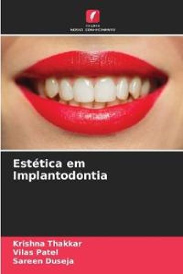 Estética em Implantodontia