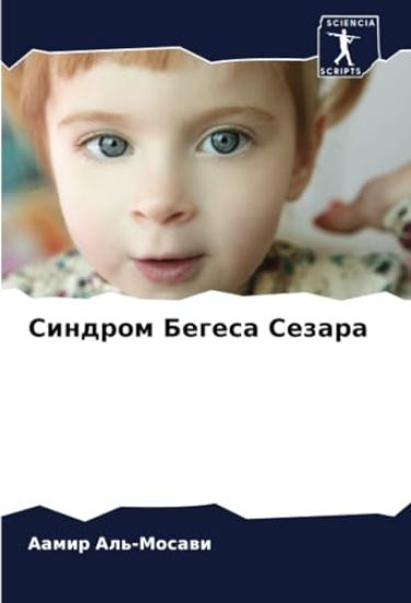 Sindrom Begesa Sezara