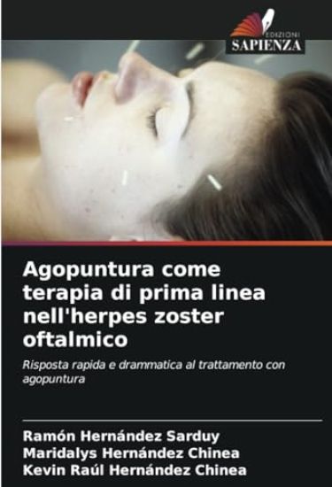 Agopuntura come terapia di prima linea nell'herpes zoster oftalmico