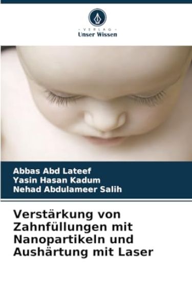 Verstärkung von Zahnfüllungen mit Nanopartikeln und Aushärtung mit Laser