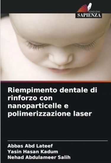 Riempimento dentale di rinforzo con nanoparticelle e polimerizzazione laser