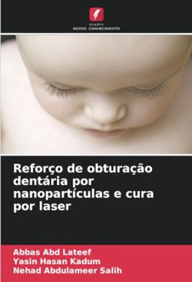 Reforço de obturação dentária por nanopartículas e cura por laser