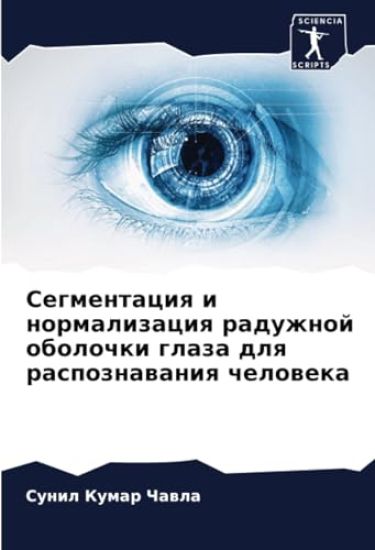 Segmentaciq i normalizaciq raduzhnoj obolochki glaza dlq raspoznawaniq cheloweka