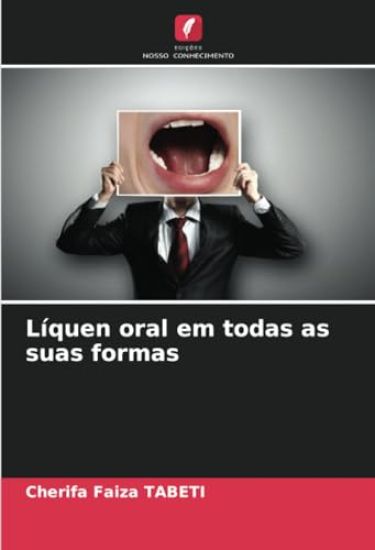 Líquen oral em todas as suas formas