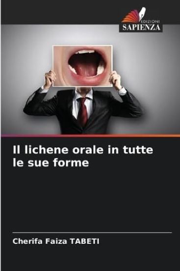 Il lichene orale in tutte le sue forme