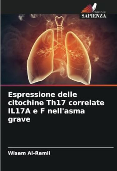 Espressione delle citochine Th17 correlate IL17A e F nell'asma grave