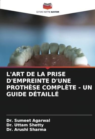 L'ART DE LA PRISE D'EMPREINTE D'UNE PROTHÈSE COMPLÈTE - UN GUIDE DÉTAILLÉ