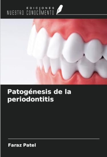 Patogénesis de la periodontitis