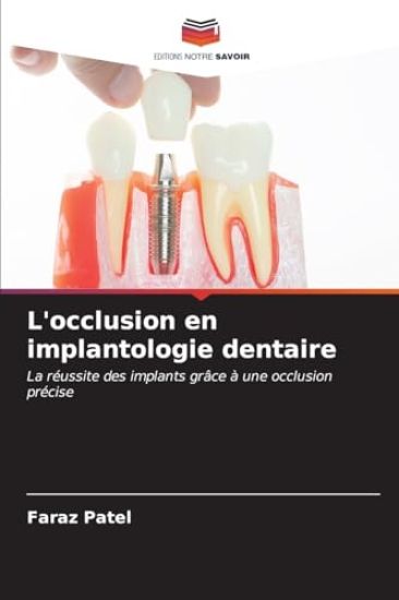 L'occlusion en implantologie dentaire