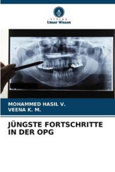Jüngste Fortschritte in Der Opg