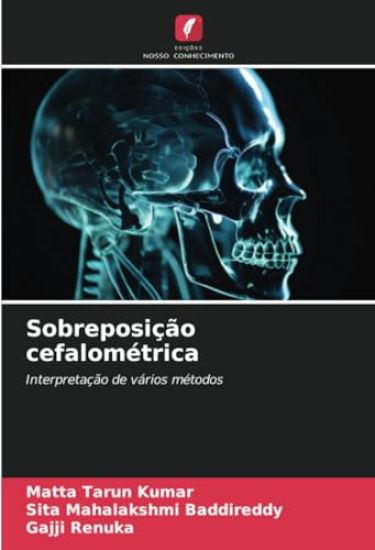 Sobreposição cefalométrica