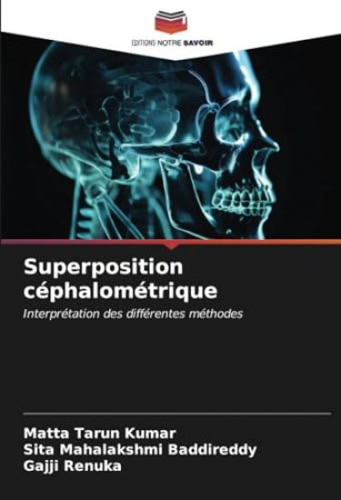 Superposition céphalométrique