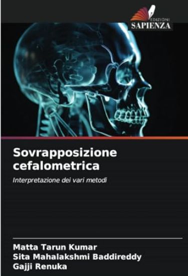 Sovrapposizione cefalometrica
