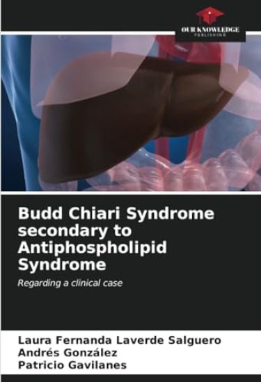 Budd Chiari Syndrome secondary to Antiphospholipid Syndrome