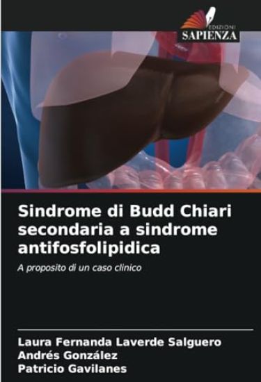 Sindrome di Budd Chiari secondaria a sindrome antifosfolipidica