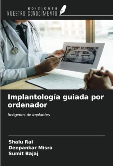 Implantología guiada por ordenador