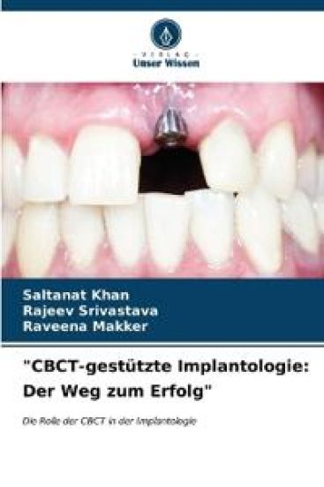 "CBCT-gestützte Implantologie
