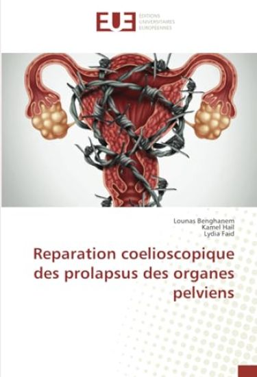 Reparation coelioscopique des prolapsus des organes pelviens