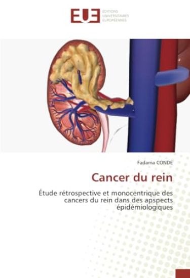 Cancer du rein